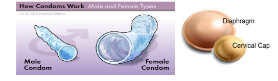 Female Condom
