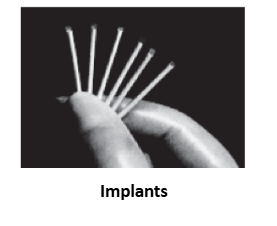 implant
