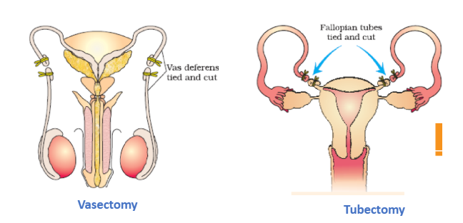 Surgical Methods