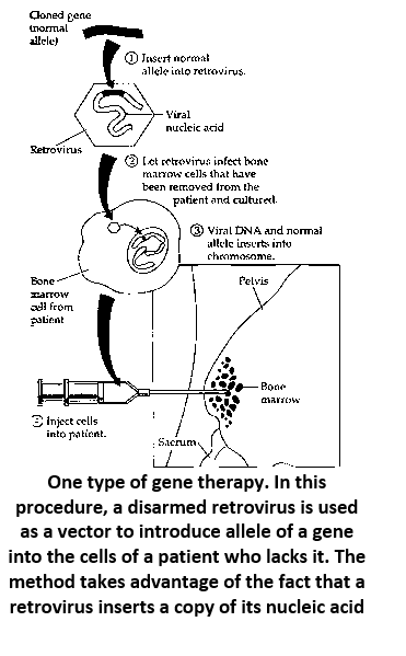 Gene Therapy