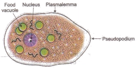 Amoebiasis (amoebic dysentery):