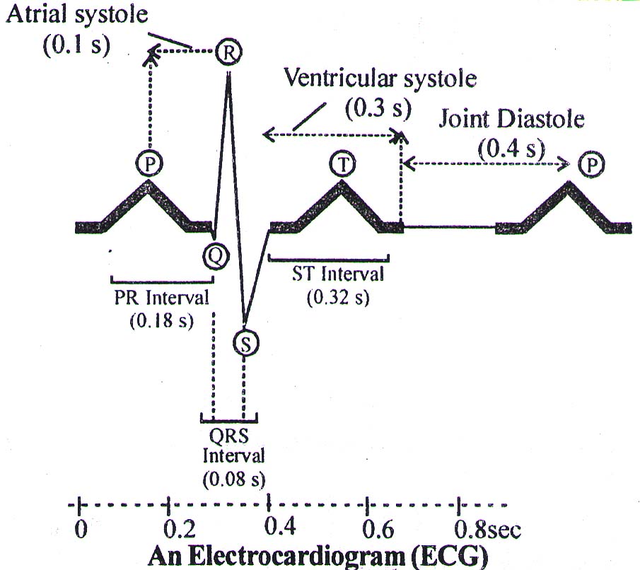 ECG